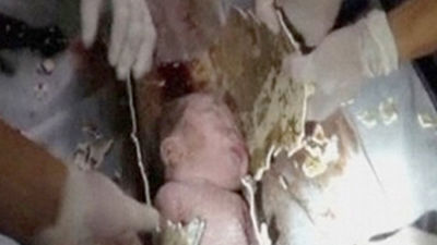 El bebé rescatado de las tuberías de un inodoro en China sale del hospital