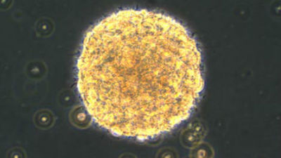 Hallan una proteína que elimina las células malignas de un tumor cerebral