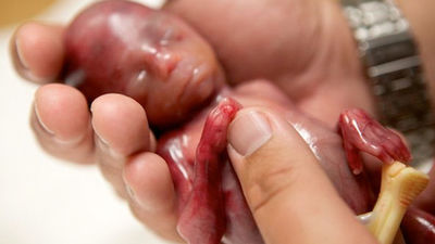 Una mujer de Indiana muestra a su bebé con solo 19 semanas de gestación