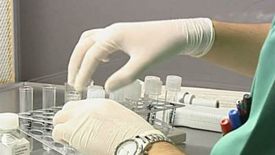 La introducción de un gen podría corregir la anomalía del síndrome de Down