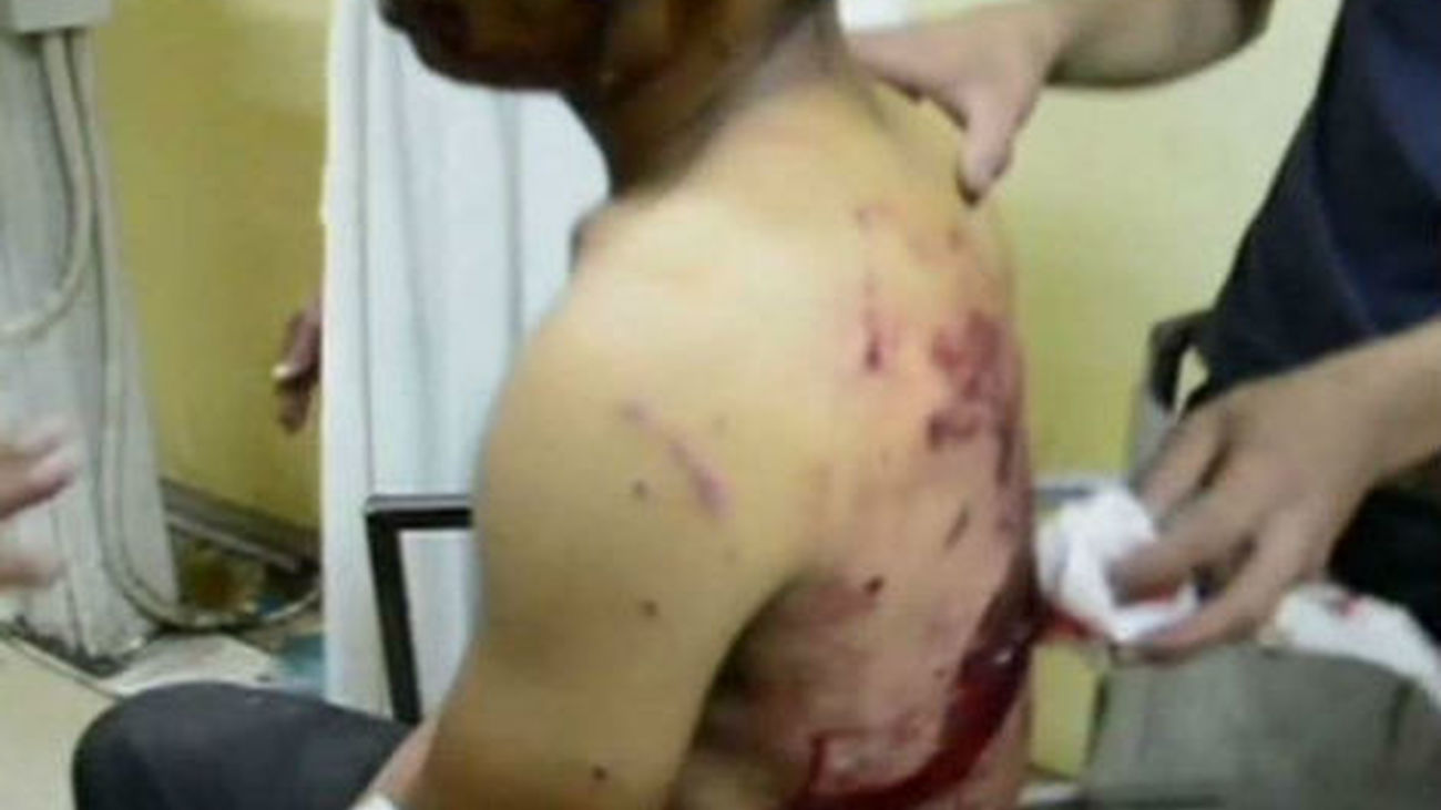 Al menos 24 heridos por una explosión frente a una comisaría de policía en Egipto