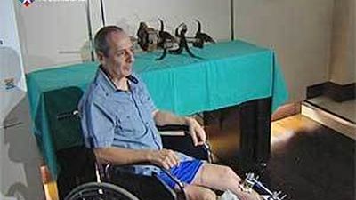 El Hospital La Paz reimplanta con éxito una pierna amputada por cuchilas de una máquina agrícola