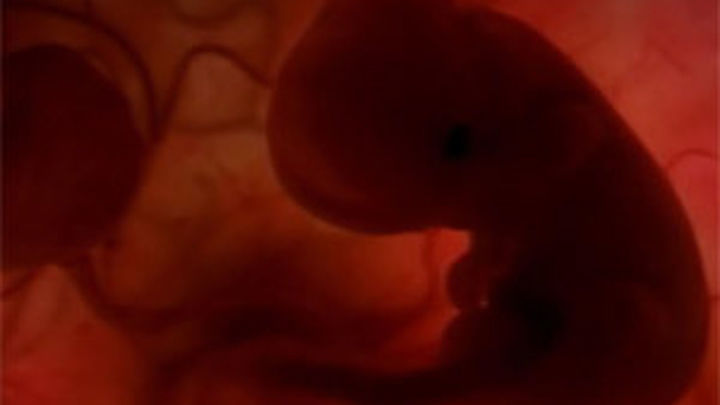 UPN plantea que sea obligatorio ver la ecografía del feto antes de abortar