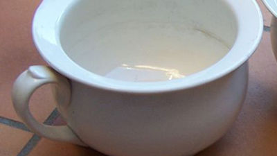 Rescatan a un niño al que le quedó atrapada la cabeza en un orinal