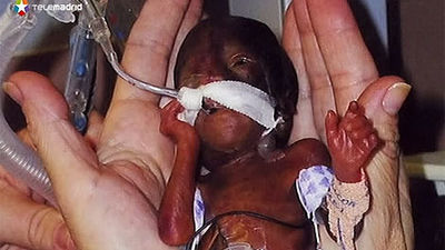 'Derecho a Vivir' urge a reformar la ley del aborto tras la sentencia a Morín