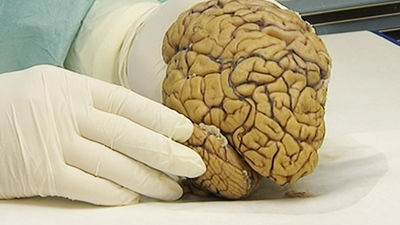 La Fundación CIEN explica a la Reina sus avances para detectar el alzhéimer