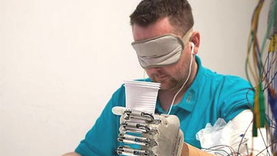 Consiguen implantar una mano biónica con sensaciones