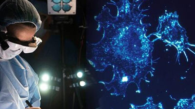 Gafas inteligentes que detectan células cancerígenas