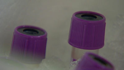 Españoles desarrollan un prueba para identificar el cáncer oral con la saliva