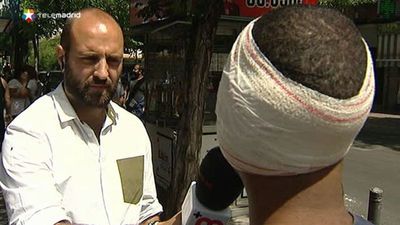 Un joven arranca a mordiscos la oreja a otro en una reyerta por celos