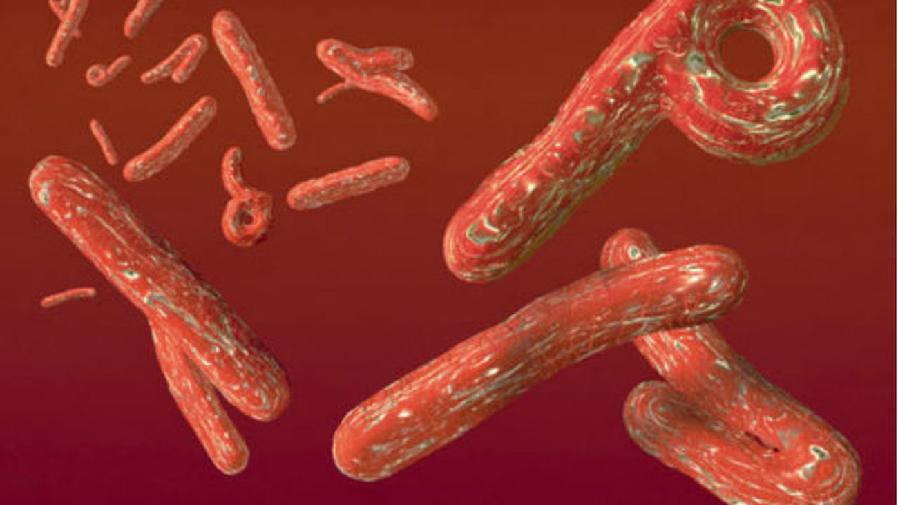 Virus de ébola