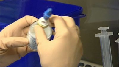 El Hospital Clínico San Carlos utilizará un robot para quimioterapia