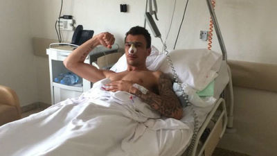 Mandzukic, operado con éxito de la fractura nasal