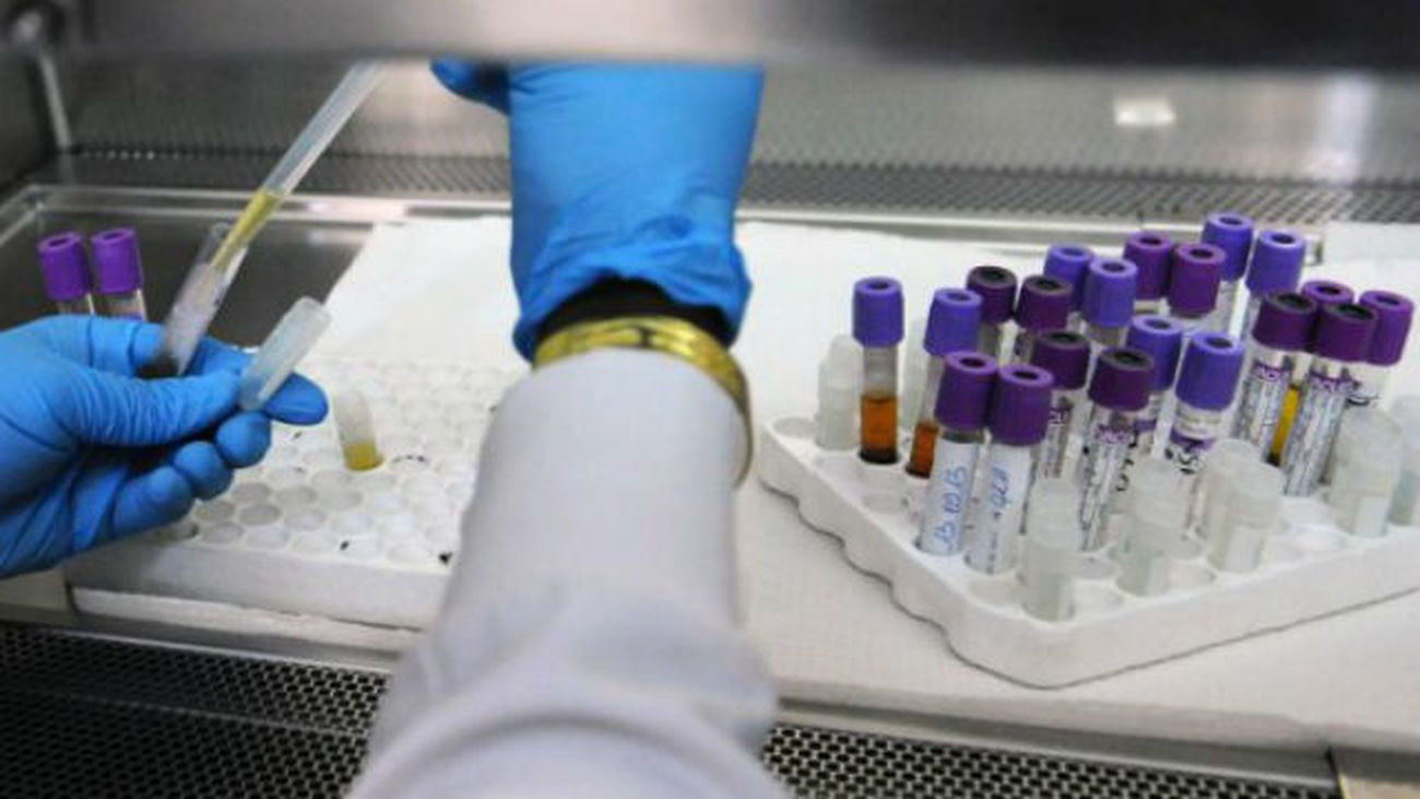 El número de muertes por sida baja un 26% en los últimos cinco años