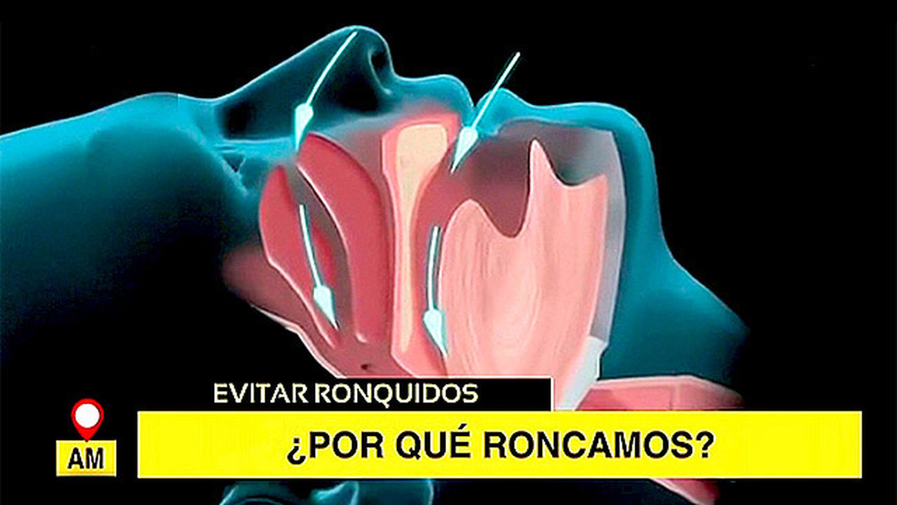 El ronquido afecta a más de la mitad de la población, sobre todo a las mujeres