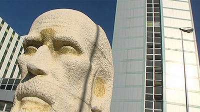 El Hospital Ramón y Cajal, pionero en el trasplante capilar reconstructivo