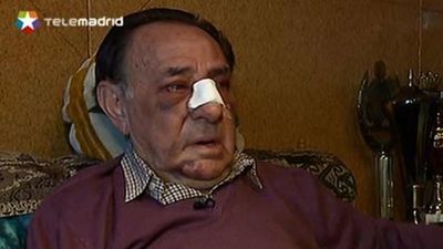 Recibe una brutal paliza en la Casa de Campo cuando practicaba deporte