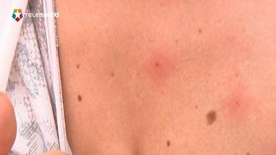 Plaga de mosquitos y mosca negra en el sureste de la región