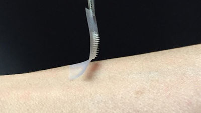 Diseñan un parche de insulina para diabéticos que podría sustituir a las inyecciones