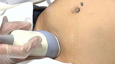 El Congreso aprueba la reforma del aborto del PP, con la ruptura de disciplina de voto