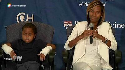 Zion, primer trasplante completo de manos y antebrazos practicado en un niño