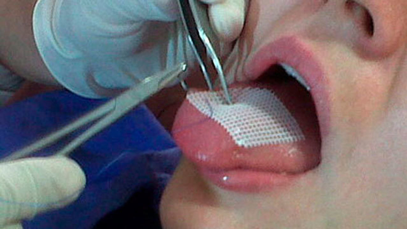 Dispuestos a todo por adelgazar