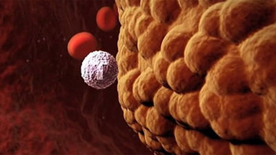 Investigación pionera para tratar con un nuevo fármaco el tumor cerebral más agresivo