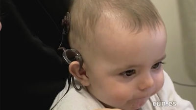 El implante coclear, el mayor enemigo de la sordera