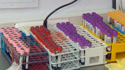 Madrid registra 248.381 donaciones de sangre  en 2015, un 1,02% menos que el año anterior