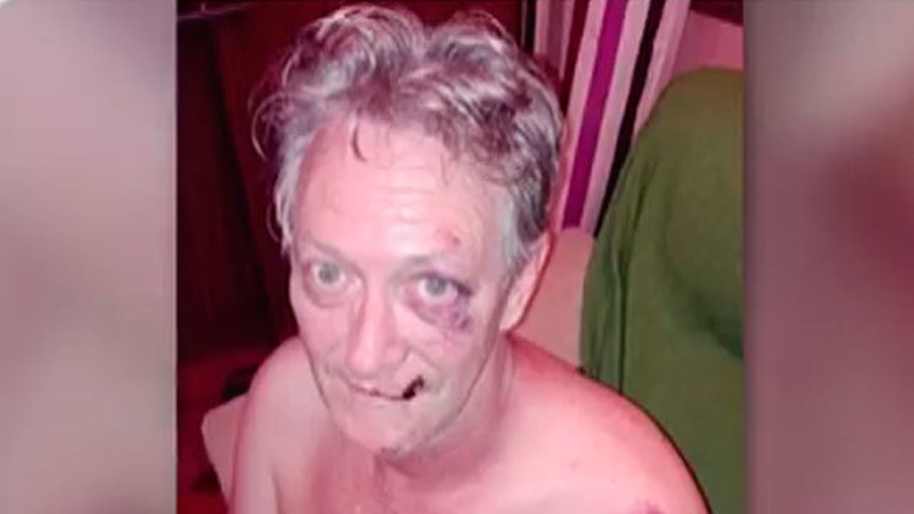 Dos jóvenes dan una brutal paliza a un vecino de Móstoles