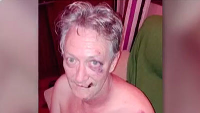 Dos jóvenes dan una brutal paliza a un vecino de Móstoles