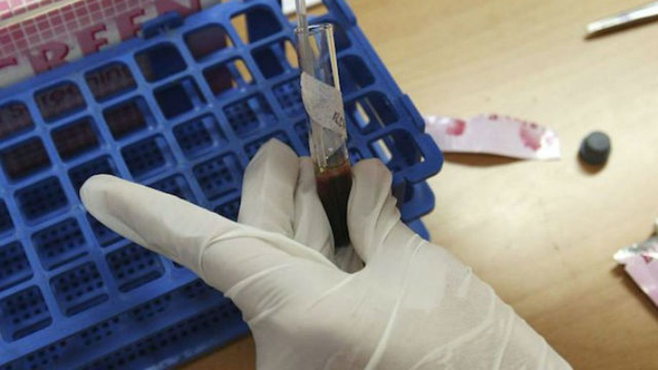 COGAM realiza un total de 94 pruebas de VIH  y Hepatitis C en sus jornadas de puertas abiertas