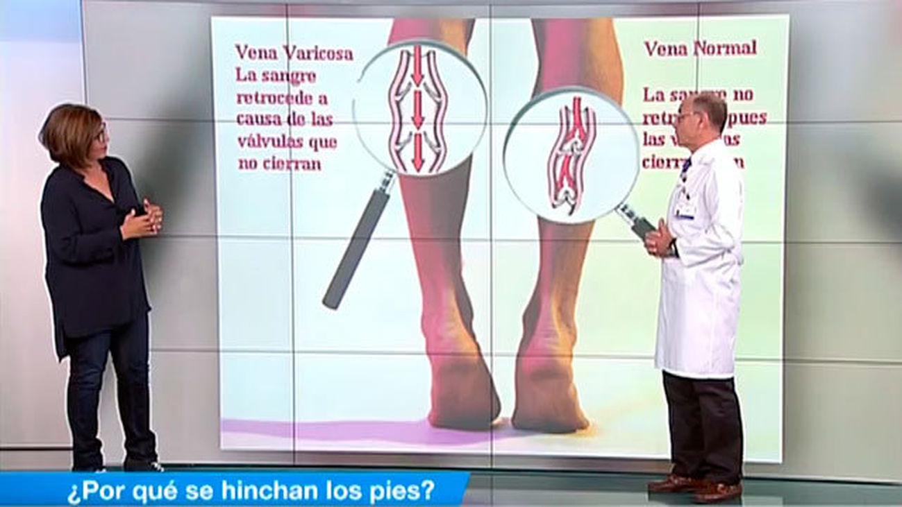 ¿Por qué se hinchan los pies?