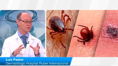 ¿Cómo quitar correctamente las garrapatas?