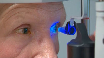 La detección temprana, clave para evitar el daño del glaucoma