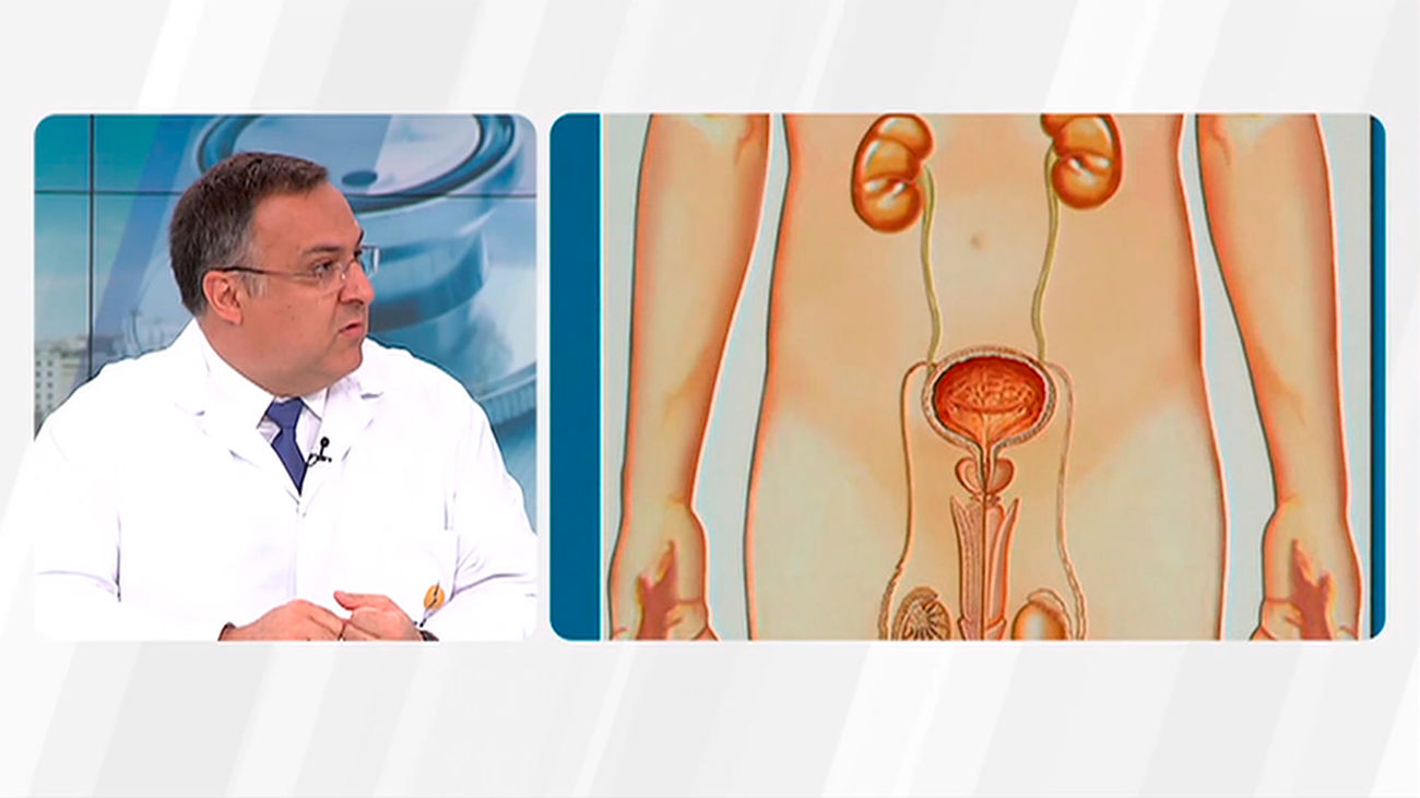 La ITV de la próstata