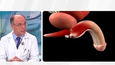 La disfunción eréctil