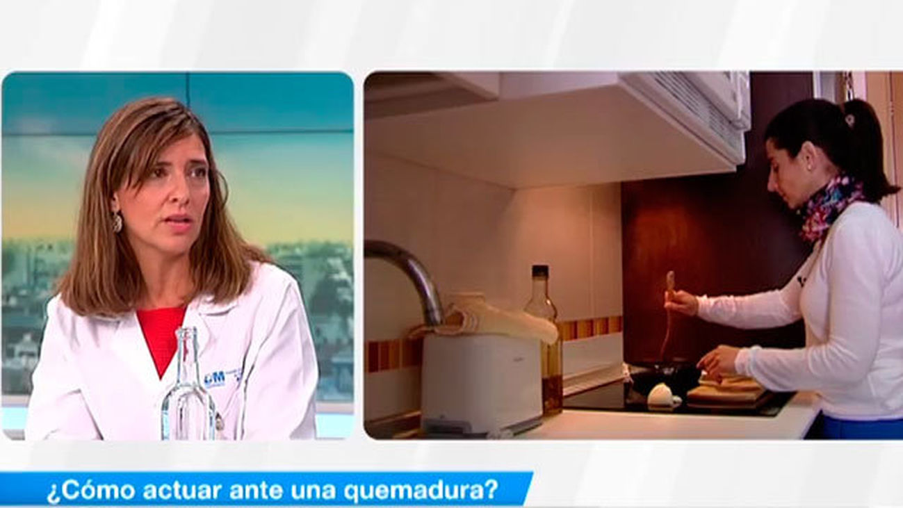 ¿Cómo actuar ante una quemadura?