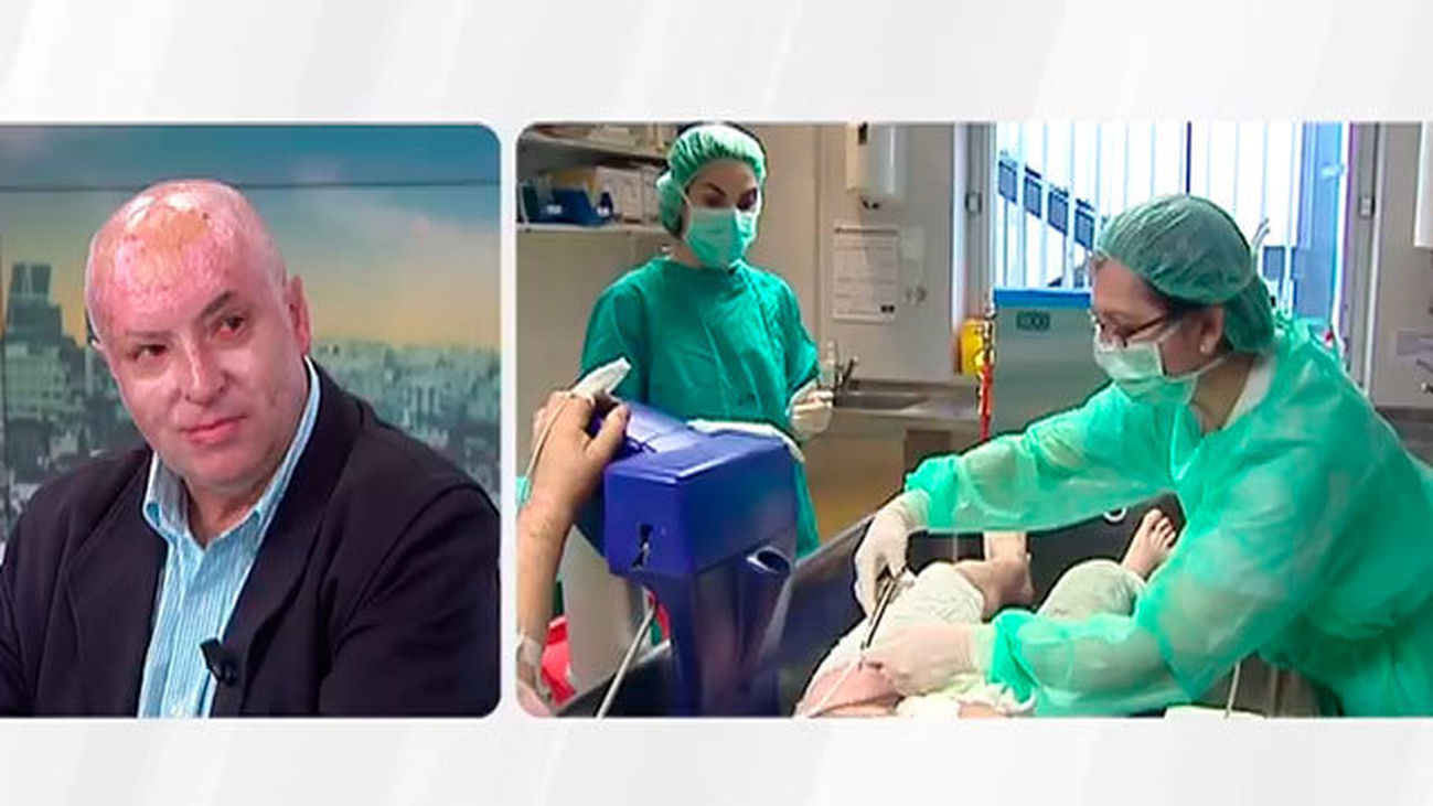 ¿Cómo trabajan en las unidades de grandes quemados?