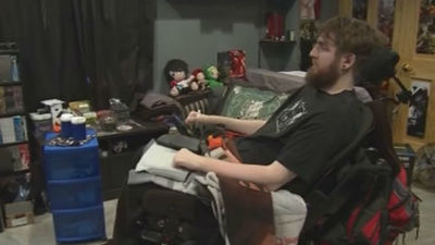 Consiguen devolver el tacto a un paciente tetrapléjico con un brazo robótico