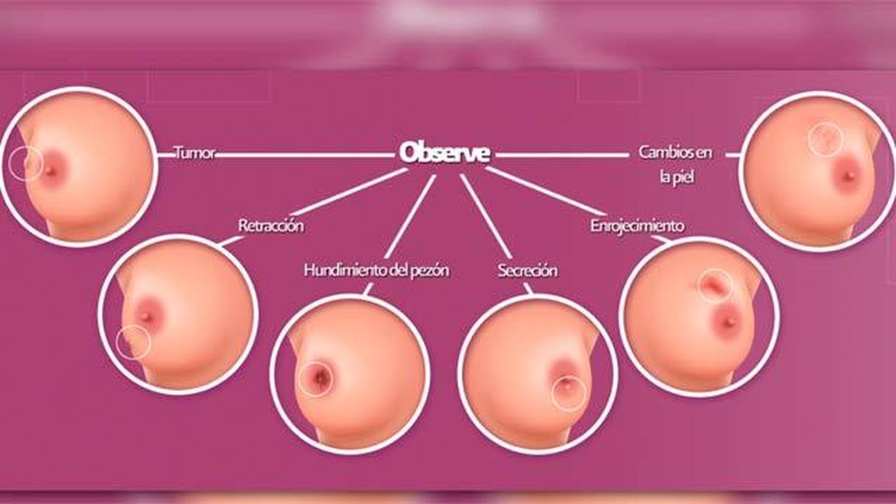 Cómo realizar la autoexploración de mamas