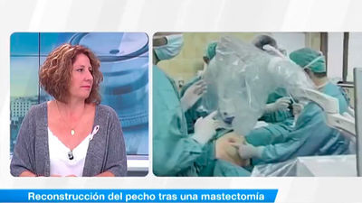 La reconstrucción del pecho tras la mastectomia