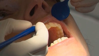 Abre en Madrid la 'Casa de las Encías' para fomentar la salud bucodental