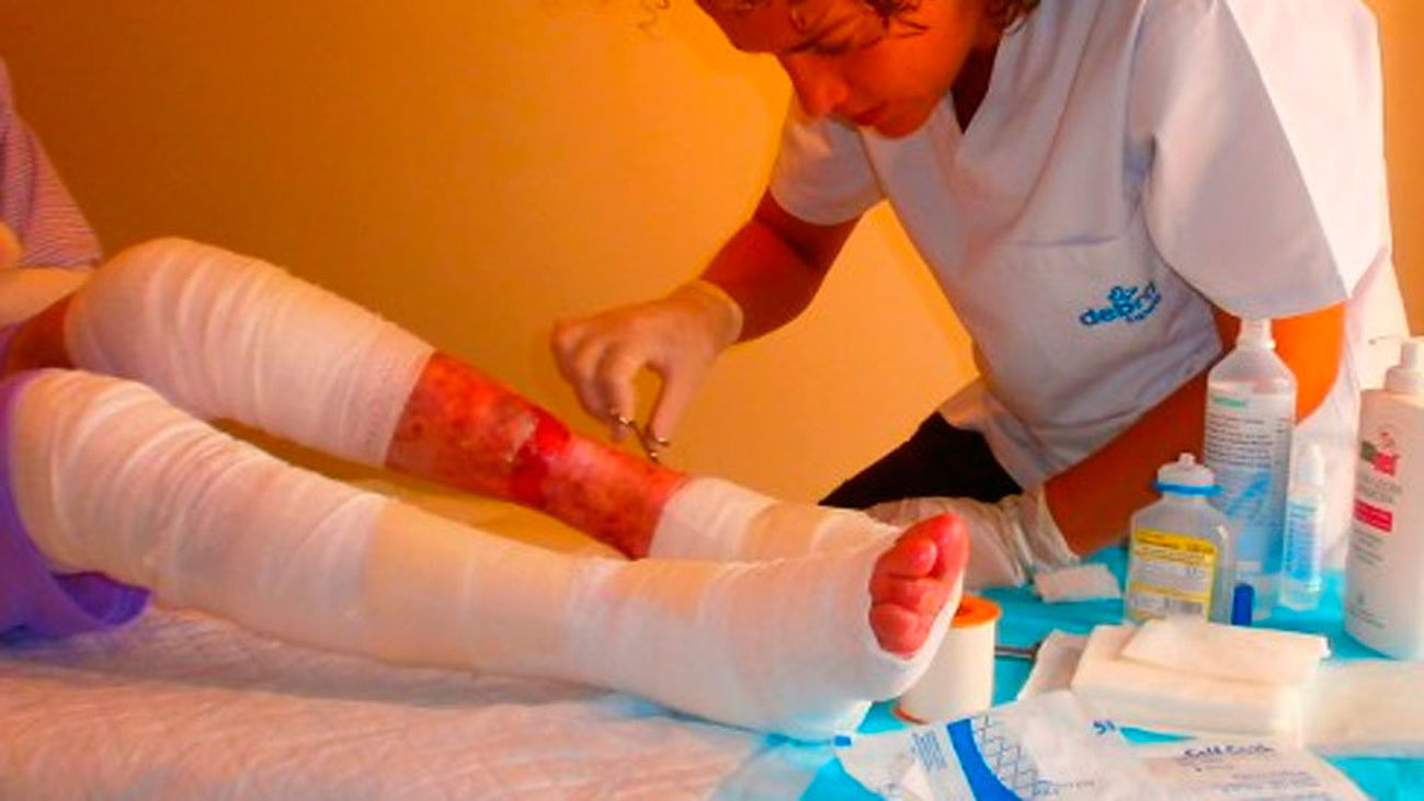 Más de mil personas padecen en España la "piel de mariposa"