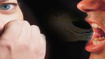 La halitosis: causas y tratamiento