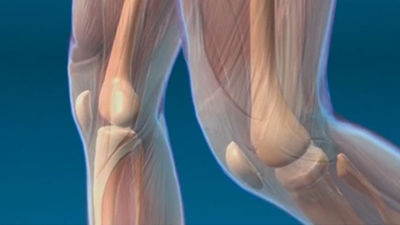 El 'fast tracks' acelera la recuperación de los operados de cadera o rodilla