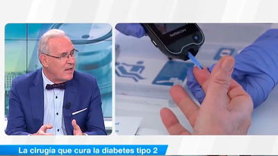 La cirugía que cura la diabetes tipo 2