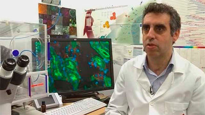 Científicos españoles descubren por qué algunos tumores resisten a la quimioterapia