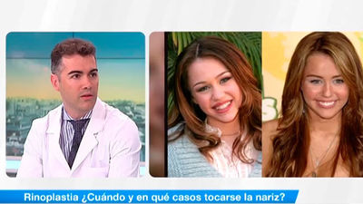 Rinoplastia ¿Cuando tocarse la nariz?