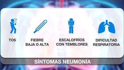 La neumonía y la vacuna del neumococo